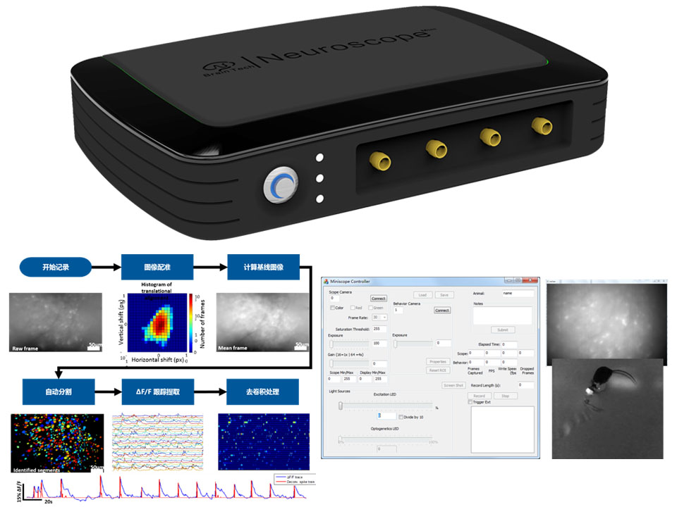 NeuroScope-超微型显微成像系统